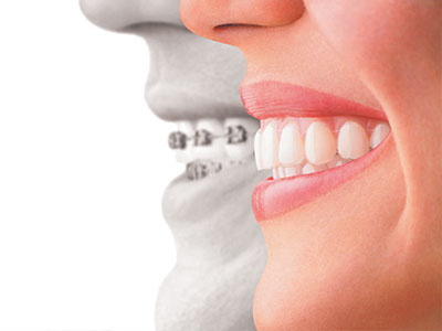 The image features a split-screen comparison of a person s natural teeth with their teeth after dental work, highlighting the difference between the two states.