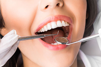 A woman with her mouth open wide, receiving dental care, with a dentist s hand visible holding dental instruments.